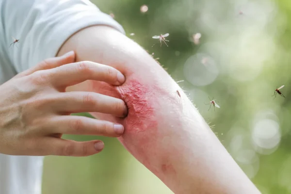 Institut Pasteur explique comment les moustiques vous repèrent et la solution pour les éviter cet été